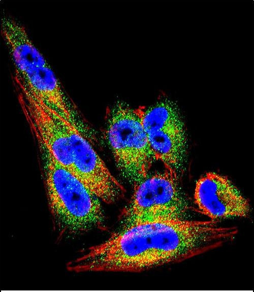 TIMP1 Antibody in Immunocytochemistry (ICC/IF)