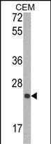 TIMP1 Antibody in Western Blot (WB)