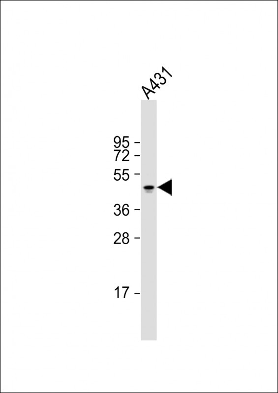 Cytokeratin 14 Antibody in Western Blot (WB)