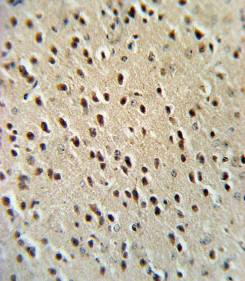 HPRT1 Antibody in Immunohistochemistry (Paraffin) (IHC (P))