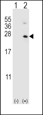 HPRT1 Antibody in Western Blot (WB)