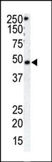 GRK1 Antibody in Western Blot (WB)