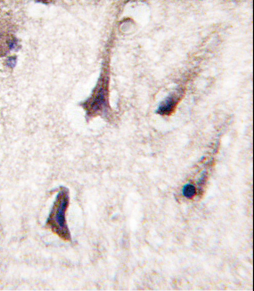 PKC beta-2 Antibody in Immunohistochemistry (Paraffin) (IHC (P))