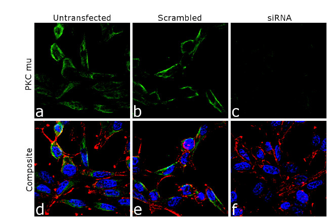 PKC mu Antibody in Immunocytochemistry (ICC/IF)