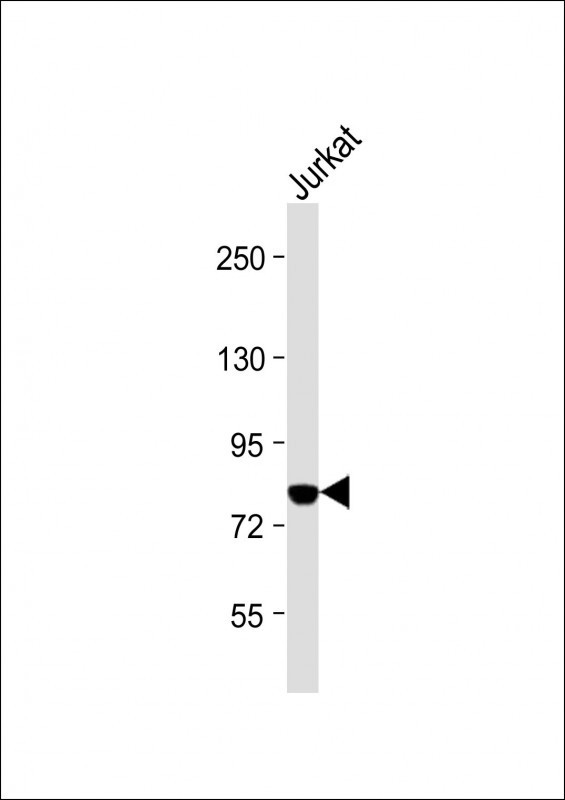 PKC theta Antibody in Western Blot (WB)