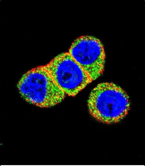 AKT2 Antibody in Immunocytochemistry (ICC/IF)