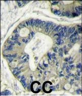 AKT2 Antibody in Immunohistochemistry (Paraffin) (IHC (P))