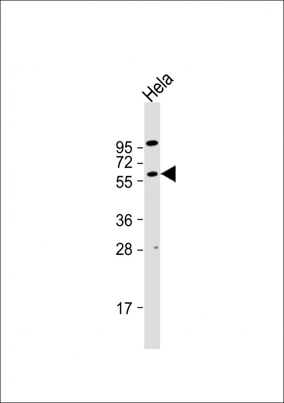 AKT2 Antibody in Western Blot (WB)