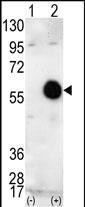 AKT2 Antibody in Western Blot (WB)