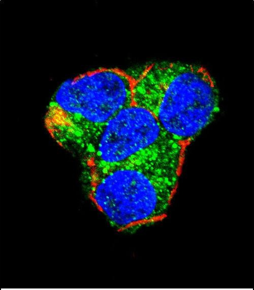 AKT2 Antibody in Immunocytochemistry (ICC/IF)