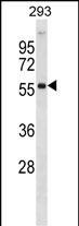 AKT2 Antibody in Western Blot (WB)