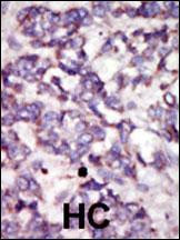 PDK2 Antibody in Immunohistochemistry (Paraffin) (IHC (P))