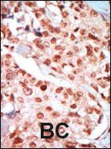 AMPK gamma-1 Antibody in Immunohistochemistry (Paraffin) (IHC (P))