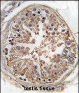 AMPK gamma-1 Antibody in Immunohistochemistry (Paraffin) (IHC (P))