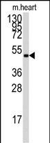 AMPK gamma-1 Antibody in Western Blot (WB)