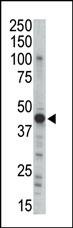 PRKAR2B Antibody in Western Blot (WB)