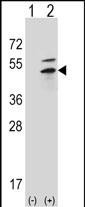 PRKAR2B Antibody in Western Blot (WB)