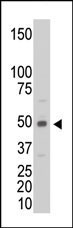 Creatine Kinase MB Antibody in Western Blot (WB)