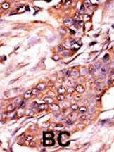 ACVR1 Antibody in Immunohistochemistry (Paraffin) (IHC (P))