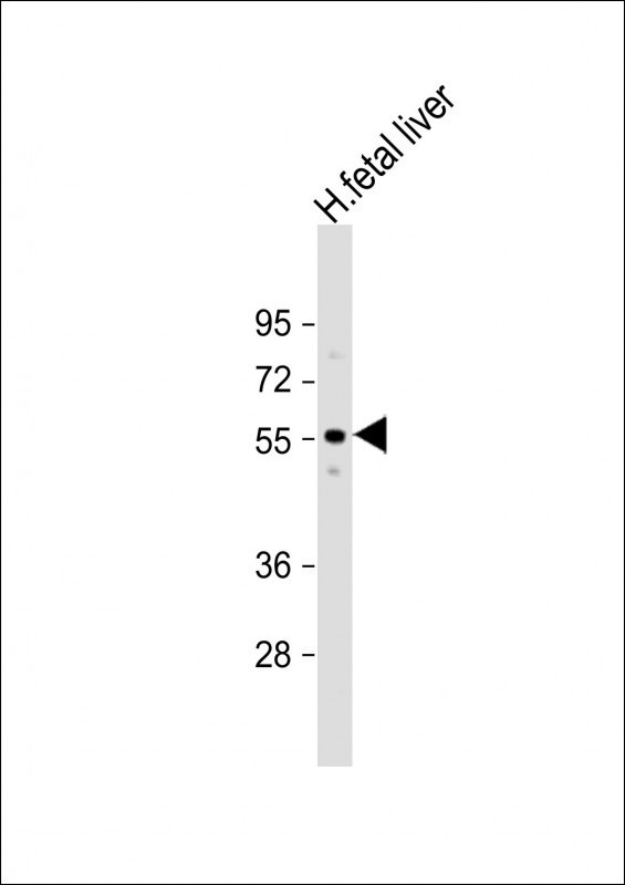 ACVR2A Antibody in Western Blot (WB)