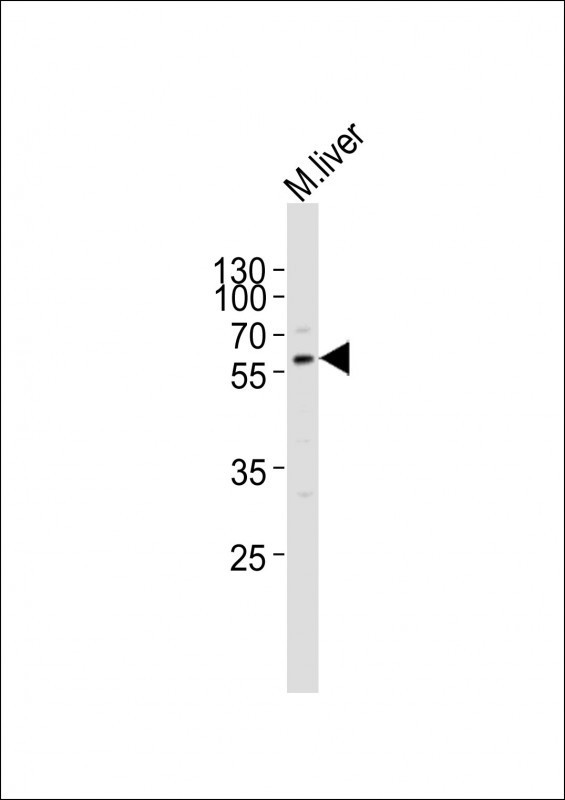 ACVR2A Antibody in Western Blot (WB)