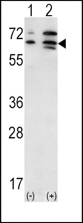 ACVR2A Antibody in Western Blot (WB)