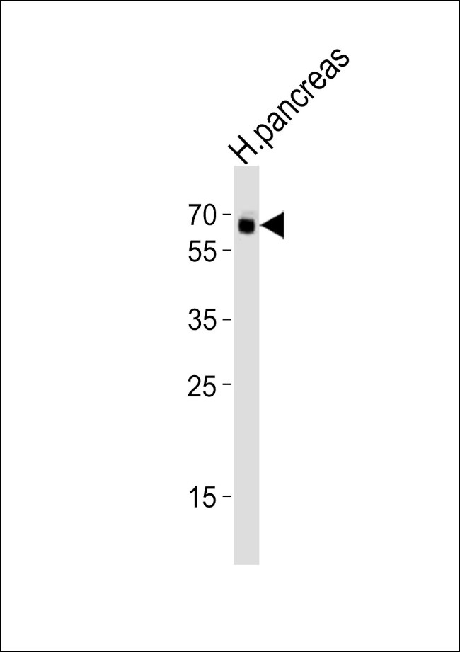 ACVR2B Antibody in Western Blot (WB)