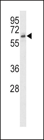 ACVR2B Antibody in Western Blot (WB)