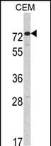 AMHR2 Antibody in Western Blot (WB)