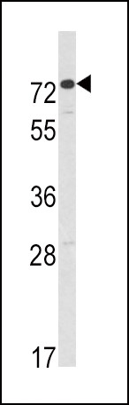 AMHR2 Antibody in Western Blot (WB)