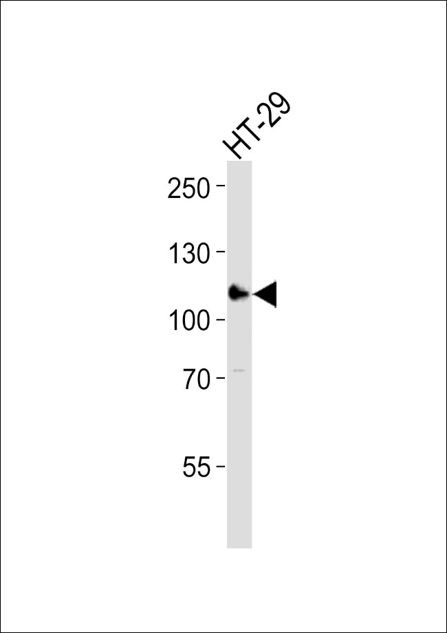 ERN2 Antibody in Western Blot (WB)