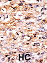 GCN2 Antibody in Immunohistochemistry (Paraffin) (IHC (P))