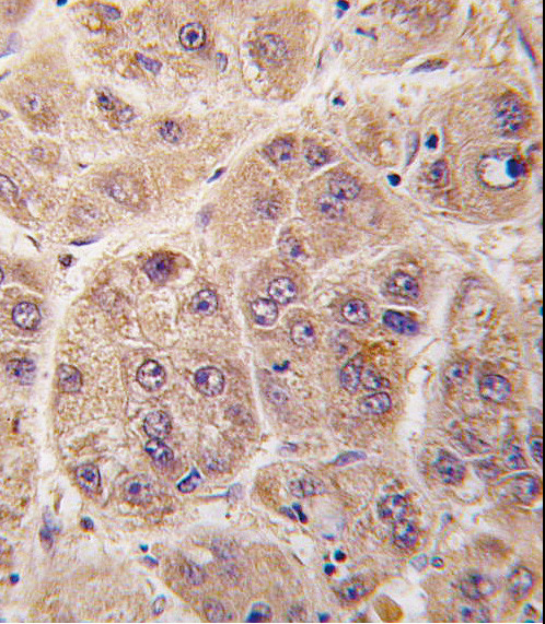 PIM3 Antibody in Immunohistochemistry (Paraffin) (IHC (P))