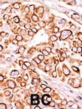 PIKFYVE Antibody in Immunohistochemistry (Paraffin) (IHC (P))