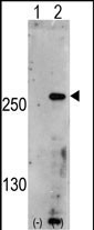 PIKFYVE Antibody in Western Blot (WB)