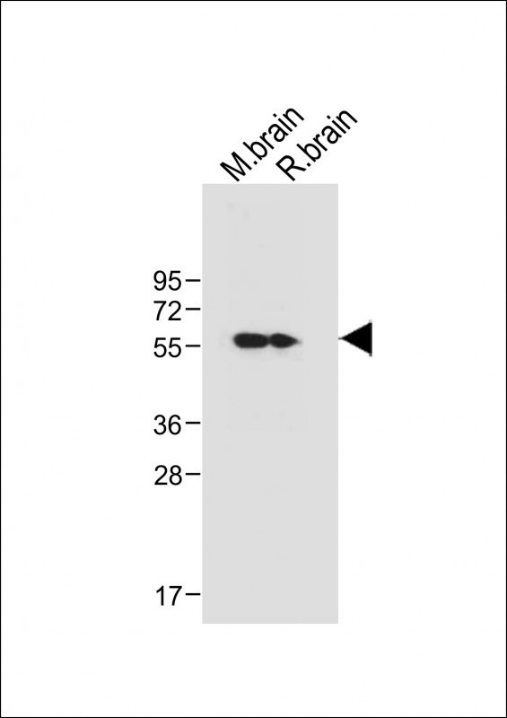 CaMKII delta Antibody in Western Blot (WB)