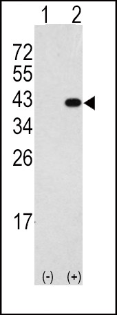 DAPK2 Antibody in Western Blot (WB)