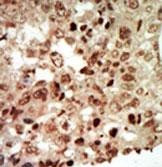 p38 MAPK beta Antibody in Immunohistochemistry (Paraffin) (IHC (P))