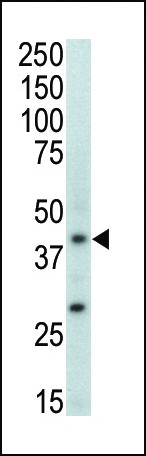 p38 MAPK beta Antibody in Western Blot (WB)