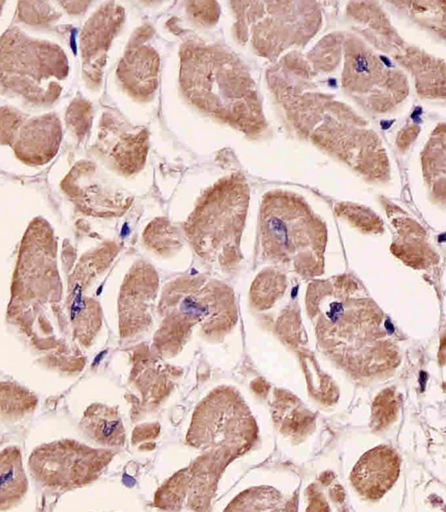 SPHK1 Antibody in Immunohistochemistry (Paraffin) (IHC (P))