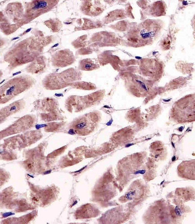 SPHK1 Antibody in Immunohistochemistry (Paraffin) (IHC (P))