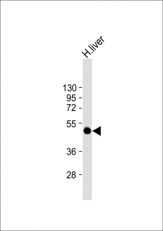 SPHK1 Antibody in Western Blot (WB)