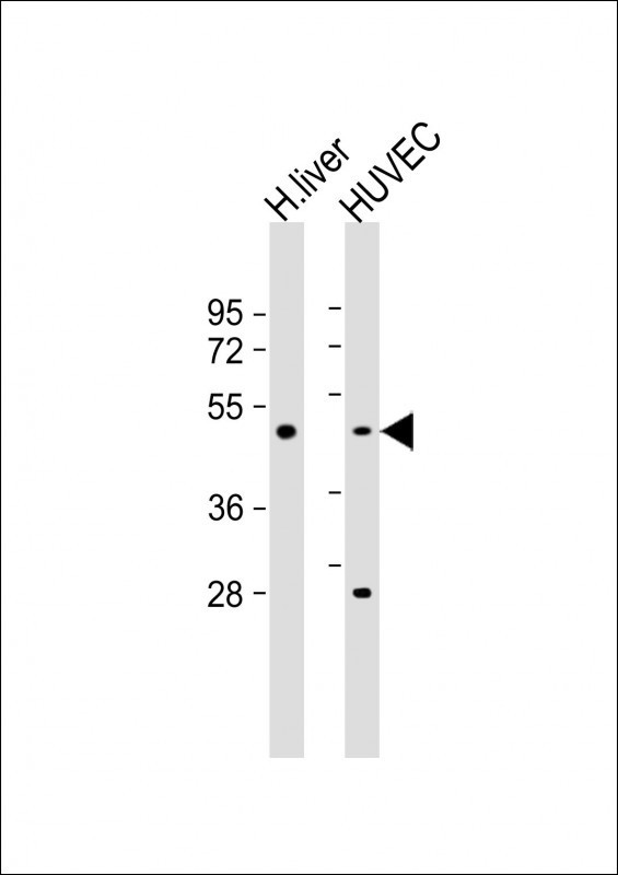 SPHK1 Antibody in Western Blot (WB)