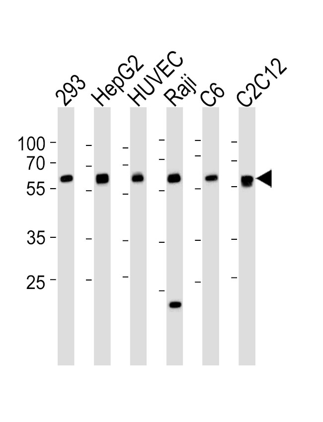 SPHK1 Antibody in Western Blot (WB)