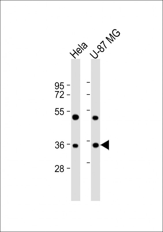 Aurora B Antibody in Western Blot (WB)