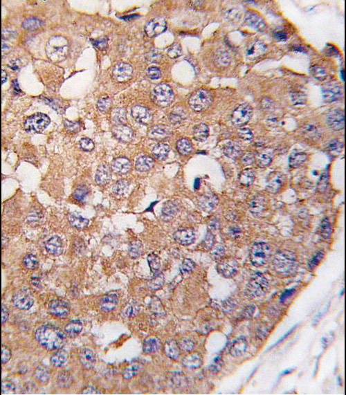 PLK2 Antibody in Immunohistochemistry (Paraffin) (IHC (P))