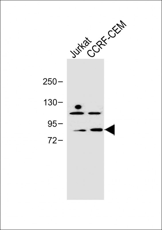 PLK2 Antibody in Western Blot (WB)