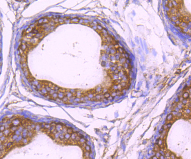 ALDH1A1 Antibody in Immunohistochemistry (Paraffin) (IHC (P))