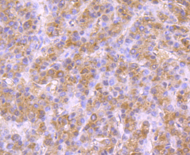 NSUN4 Antibody in Immunohistochemistry (Paraffin) (IHC (P))