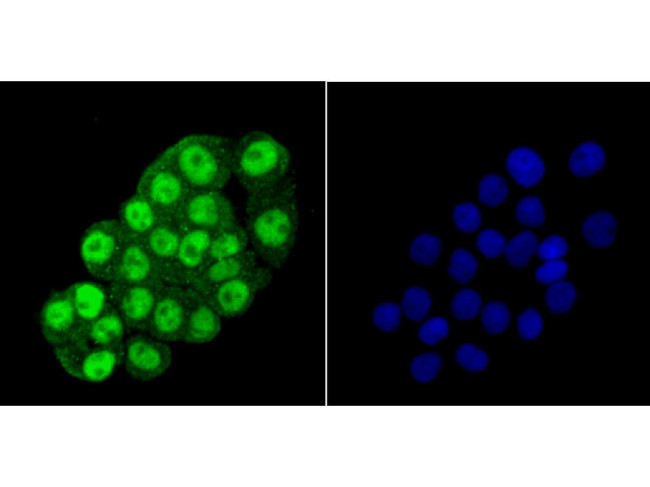 HDAC2 Antibody in Immunocytochemistry (ICC/IF)